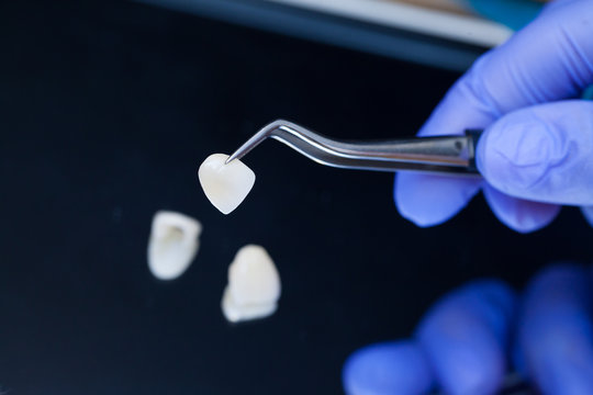What to Expect During Your First Emergency Dental Appointment in the UK